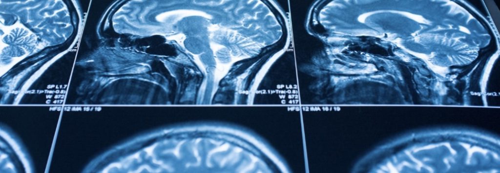 image of scanned brains