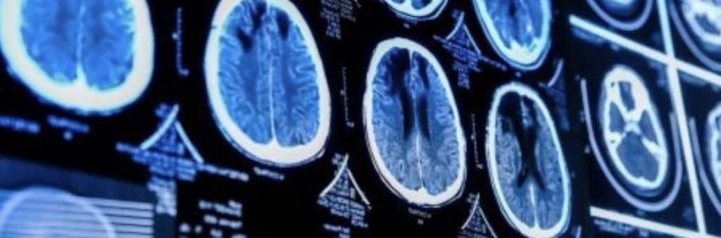 Medical images of brains